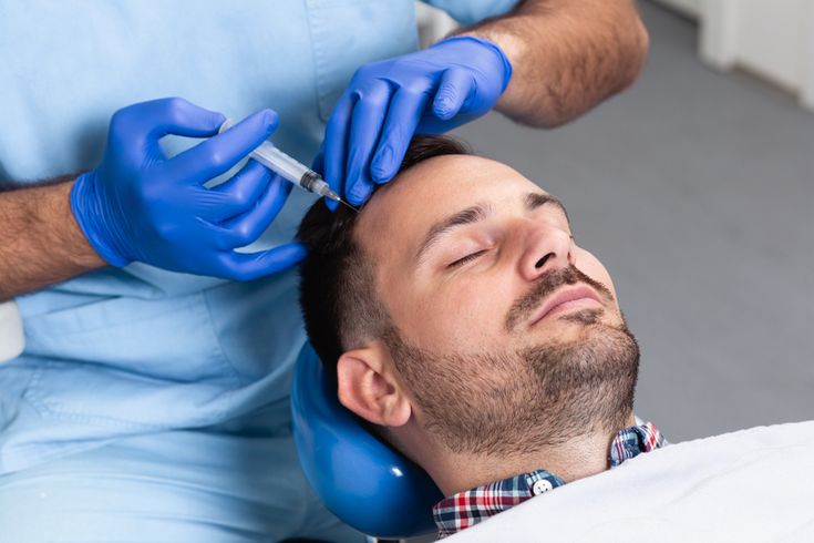 زراعة الشعر في اسطنبول، اسطنبول ، زراعة الشعر.