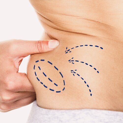 شفط-الدهون-في-اسطنبول،-شفط-الدهون،-عمليات-التجميل،-جراحي-التجميل،-المرافق-الطبية