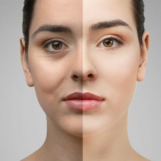 تجميل الجفن في اسطنبول