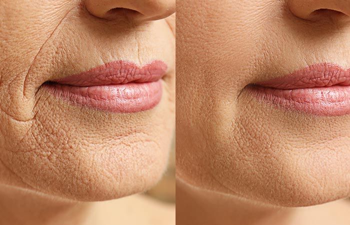 شد الوجه في اسطنبول