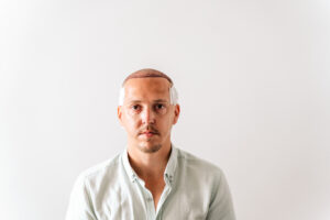 hair transplant procedure